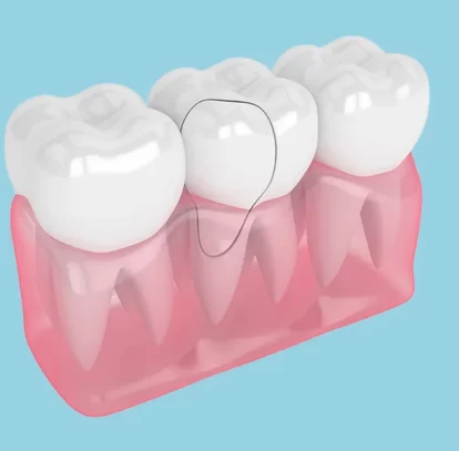 Cracked Tooth Pain Causes, Treatment, and When to Call Your Dentist